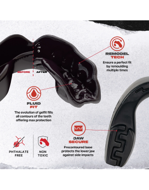 Safejawz Intro Series Black – Adjustable and Secure Mouthguard for Boxing, MMA and Kickboxing